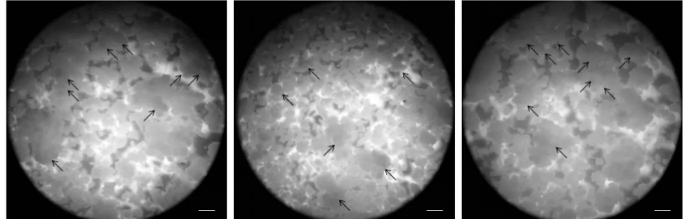 Fig. 6 Different size cell aggregates and somatic embryogenesis on the surface of cell aggregates