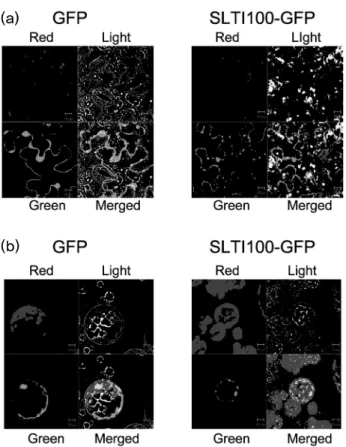 Fig. 4 Confocal images of GFP and SLTI100-GFP protein in N. 