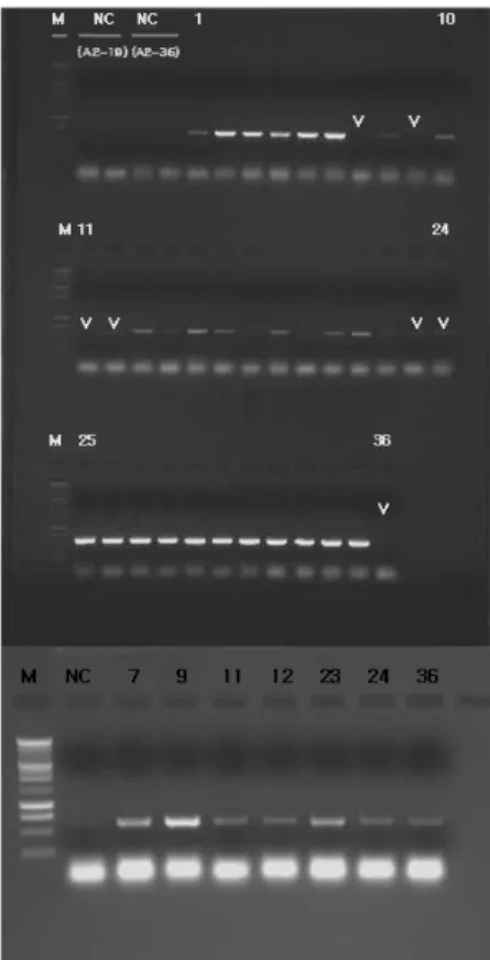 Fig. 3 Expression of transgene in SOD2 transgenic petunia T 2  36  plants by RT-PCR analysis