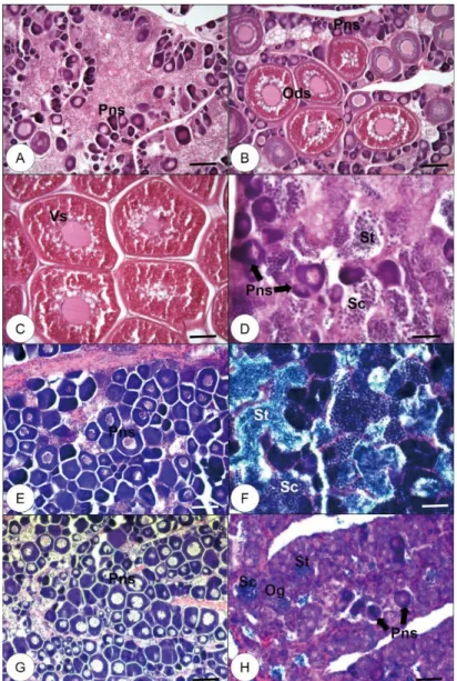 Fig. 3.   Histological observation of red spotted grouper gonad collected from July to September, 2019