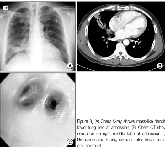 Figure 3. (A) Chest X-ray shows mass-like density with distinct margin on right lower lung field at admission