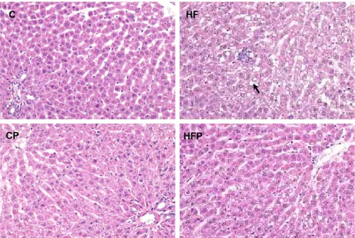 Fig. 5. Effect of dietary supplementa- supplementa-tion of grape pomace on micrographs of liver tissue in rats fed a normal or high fat diet (hematoxylin and eosin stain,