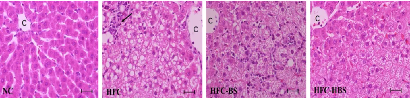Fig. 3. Photomicrographs of liver tissue (bar: 25 micrometer) of rats fed with experimental diets for 5 weeks (HE stain).