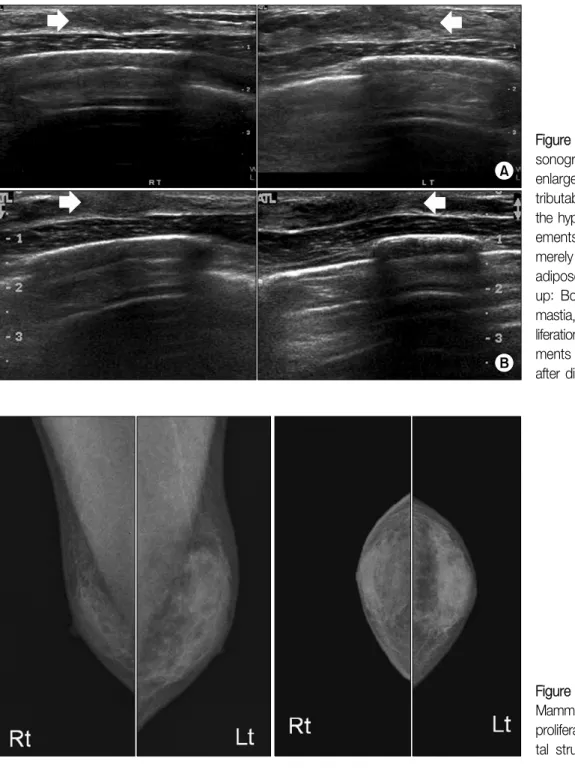 Figure  3.  Mammography. 