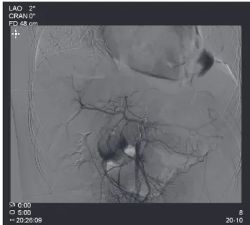 Fig. 1. Initial X-ray showing a dislocated spine and normal heart con-
