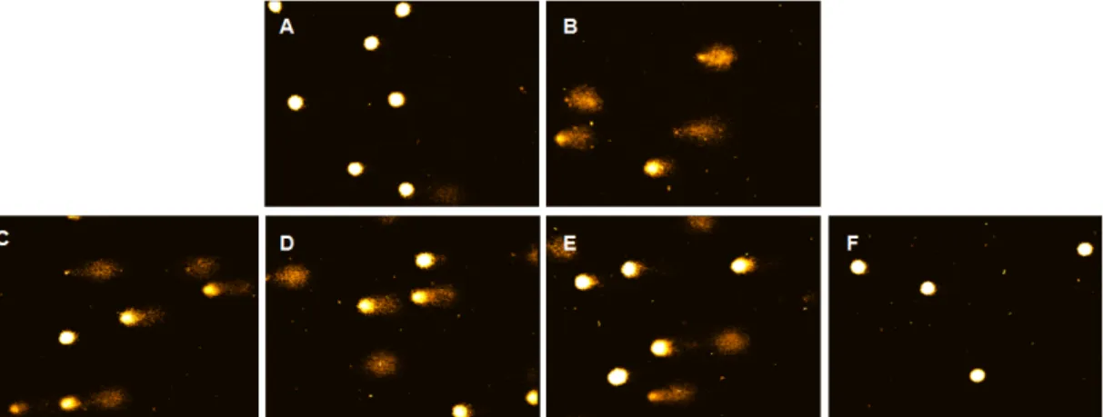 Fig.  4.  Micrographs  representing  images  obtained  from  the  comet  assay.  A,  without  oxidative  stimulus;  B,  200  μ M  H 2 O 2   treated  positive  control;  C,  RGE  1  μ g/mL＋H 2 O 2 ;  D,  RGE  5  μ g/mL＋H 2 O 2 ;  E,  RGE  10  μ g/mL＋H 2 O 2