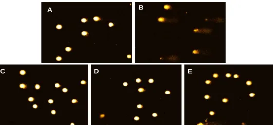 Fig.  8.  Micrographs  representing  images  obtained  from  the  comet  assay.  A,  without  oxidative  stimulus;  B,  200  μ M  HNE  treated  positive  control;  C,  RGE  1  μ g/mL＋HNE;  D,  GGE  1  μ g/mL＋HNE;  E,  PGE  1  μ g/mL＋HNE