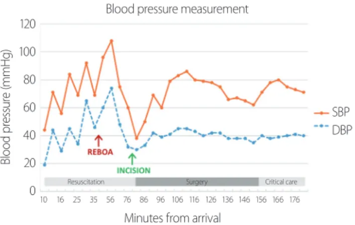 Fig. 3. Time course during REBOA performance  (time interval from arrival). REBOA: resuscitative  endovascular balloon occlusion of the aorta, SBP: 
