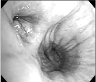 Figure  2.  (A)  Kidney:  LM:  The  glomeruli  appear  normal.  The  interstitium  shows  focal  mononuclear  cell  infiltration  and edema  (H&amp;E  stain,  ×200)