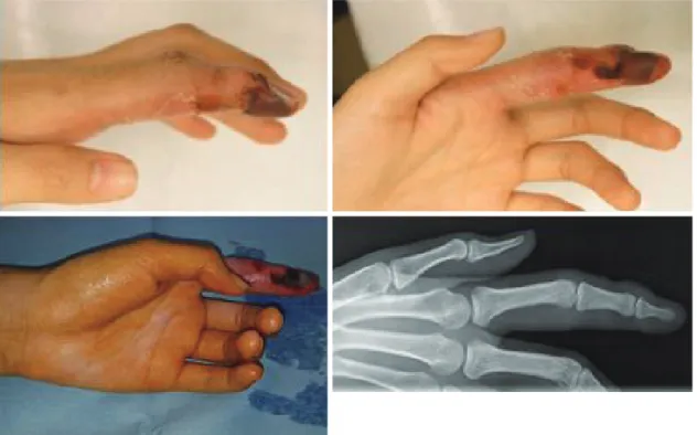 Fig. 1. Gross photograph and X-ray of the initial visit. 