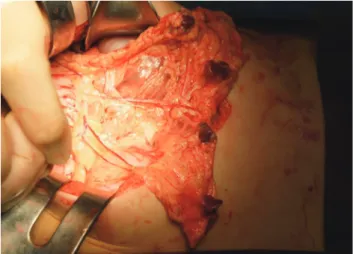 Fig. 1. Spleen graft was implanted in greater omentum.