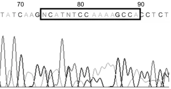 Figure  2.  The  in-frame  deletion  mutation  in  codon  746-750  of  exon  19  was  noted  on  the  EGFR  mutation analysis.