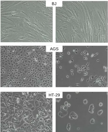 Fig.  4.  Effects  of  the  methanol  extracts  from  16  months  rip- rip-ened  Doenjang  on  cell  viability