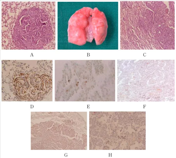 Table 2. PCNA and apoptotic labeling index of the  mice  lung  lesions  during  urethane-induced   car-cinogenesis
