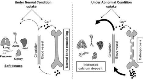 Fig.  2.  The  coordination  between  hard  tis- tis-sue  (bone)  decalcification  (osteoporosis)  and  soft  tissue  calcification