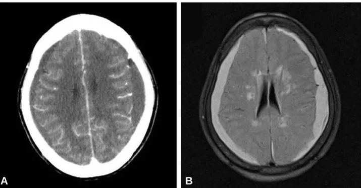 Fig. 2. Follow-up computed tomography image obtained after 2 month showing complete disappearance of the hematoma.