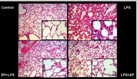 Figure 4.  Histopathologic examination shows high levels of inflammatory cellular infiltration, hemorrhage, and  alveolar wall thickening in the LPS group