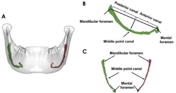 Fig. 1.  A. Three­dimensional (3D) model of the mandible, including the right and left mandibular canals from a healthy sample subject