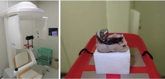 Fig. 1.  Cone-beam computed tomography (CBCT) unit. A surgical specimen of the jaw is fixed to the chin rest for CBCT.