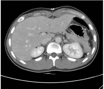 Fig. 3. Compute tomography finding of post-operative 7 days.