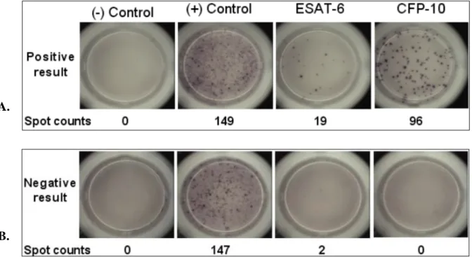 Figure 2.  Representative positive (A) and negative (B) results of T SPOT-TB analysis