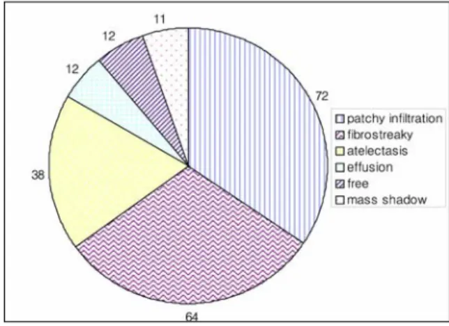 Table 2 : Age distribution of the cases Table  4.  Radiologic  findings  of  the  endobronchial  tuberculosis patients