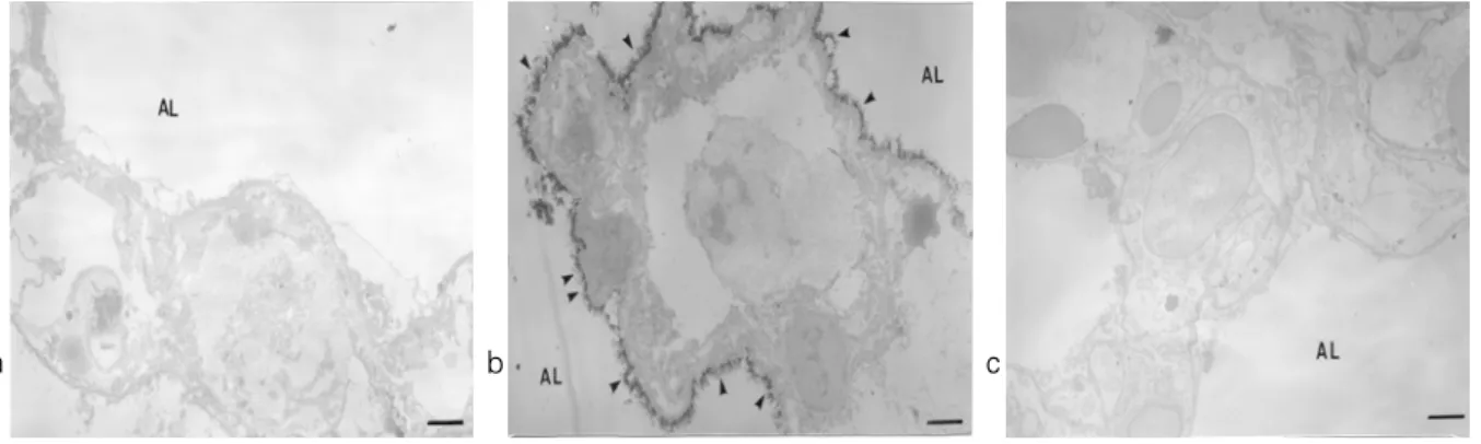 Figure 11. Detection of hydrogen peroxide with CeCl 3  cytochemical electron microscopy