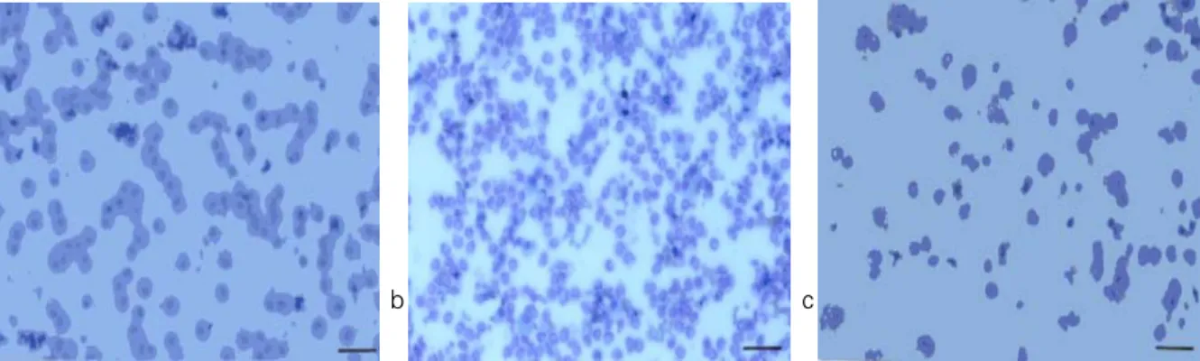 Figure 10. Ultrastructural  changes  of  the  lung  in  endotoxin  and  endotoxin  with  diltiazem  treated  rats