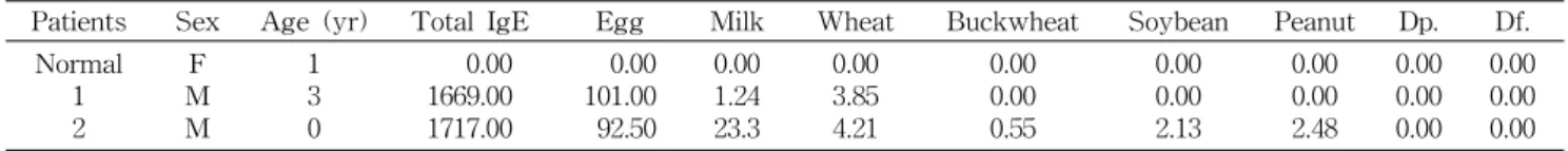 Table  1.  Biological  characteristics  of  wheat  sensitized  patient's  sera (kU A /L)