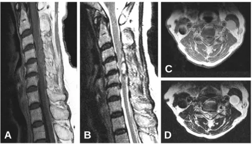 Fig. 1. MRI of Case 1