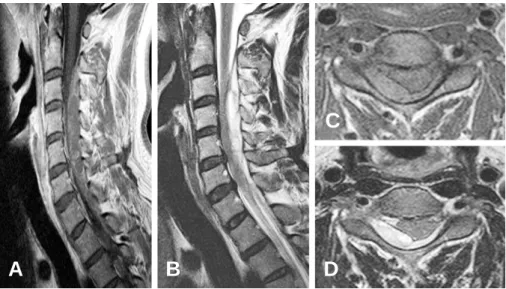 Fig. 2. MRI of Case 2