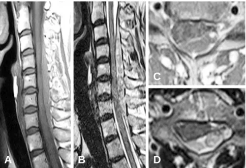 Fig. 5. MRI of Case 5