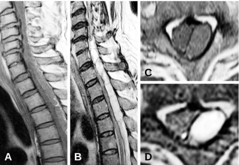 Fig. 6. MRI of Case 6