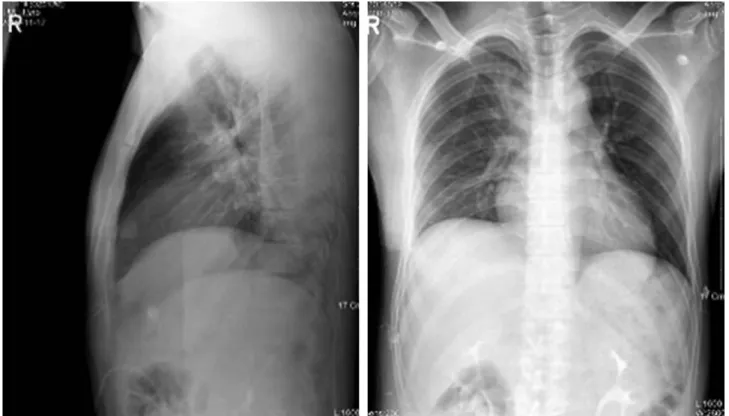 Fig. 2. The patient’s abdominal tomogram revealed bleeding site from the liver.