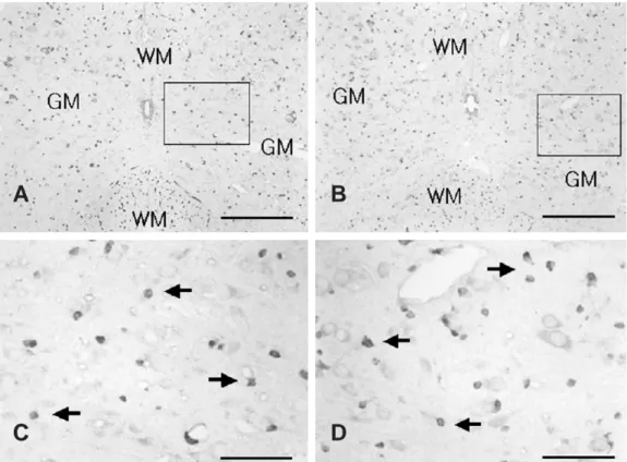 Fig. 1. Prx I immunoreativity in the spinal cord after acute immobilization stress in young rats