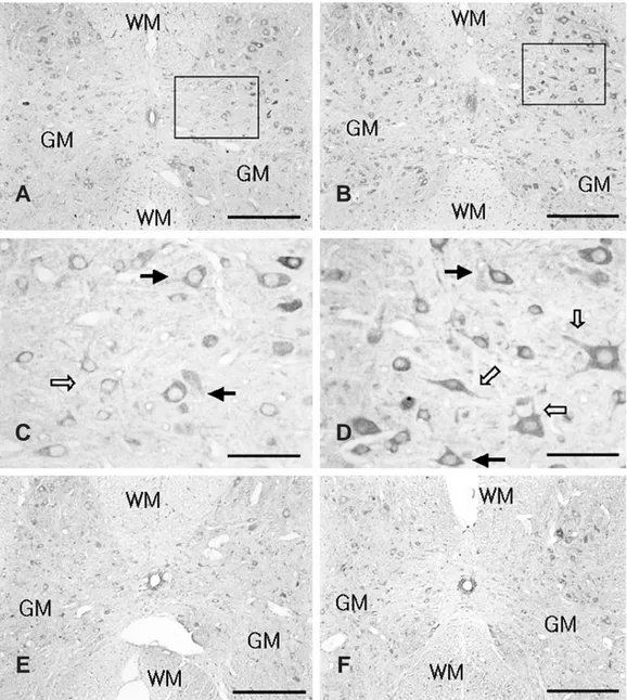 Fig. 4. Prx III immunoreactivities in the spinal cord after acute immobilization stress in young and adult rats
