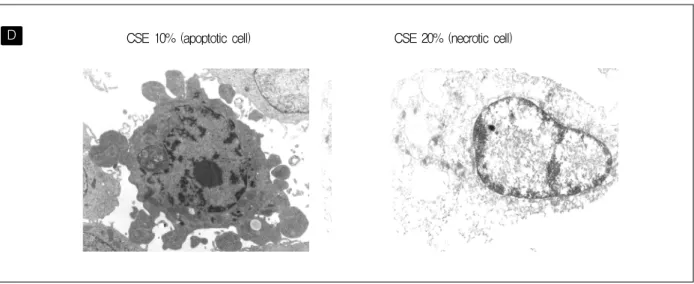 Figure  2. (D)  Apoptotic  feature  (convolution  of  cell  and  nuclear  outlines,  mass  of  condensed  chromatin)  also  well  demonstrated  by  electron  microscopy  48hr  after  addition  of  10%  CSE