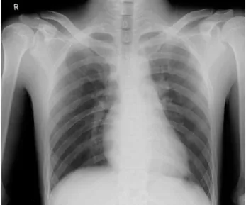 Fig. 1. Initial Chest X-ray. There was no abnormal findings on the initial radiographic study.