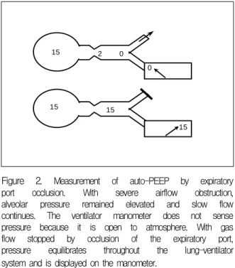 Table  1.  Comparison  of  static  and  dynamic  auto-PEEP