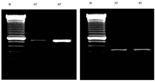 Fig. 5. Band densities of iNOS gene expression in lung tissues.