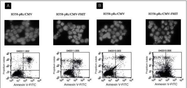 Fig. 6.  Cisplatin  and  paclitaxel  induce  markedly  increased  apoptosis  in  cells  transfected  with  FHIT  gene
