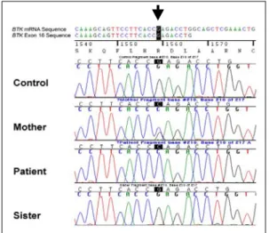 Fig. 2. Mutation  analysis  of  the  BTK  gene. 
