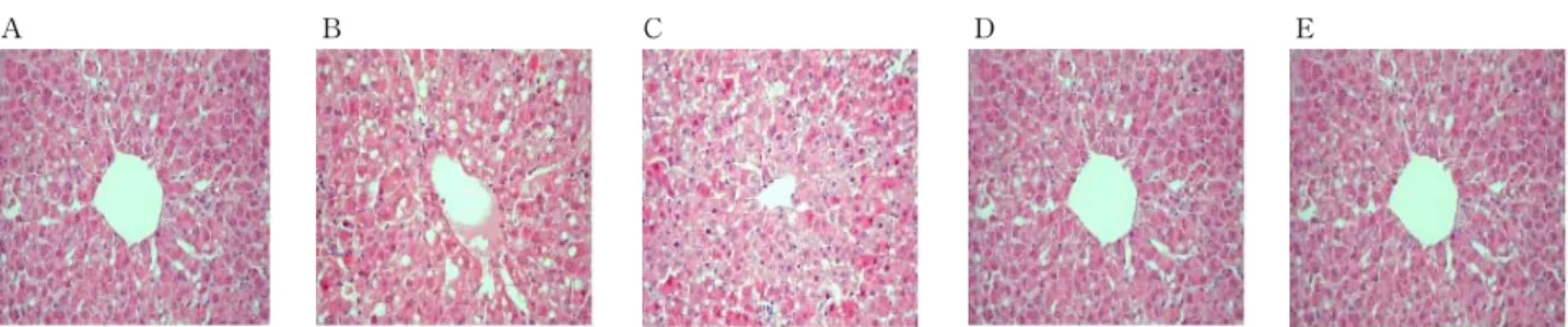 Fig.  5.  Histology  of  samples  from  normal  control  (A),  DWE-C  (B),  GalN-C  (C),  DWE  Ⅰ  (D),  and  DWE  Ⅱ  (E).
