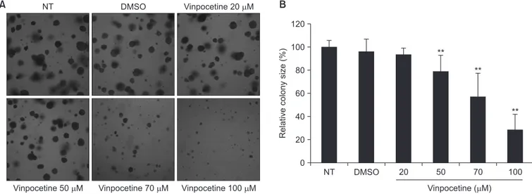 Fig. 2.  Effect of vinpocetine on cell proliferation in human colon cancer cells. (A) Cell growth ability was evaluated by soft-agar colony formation assays