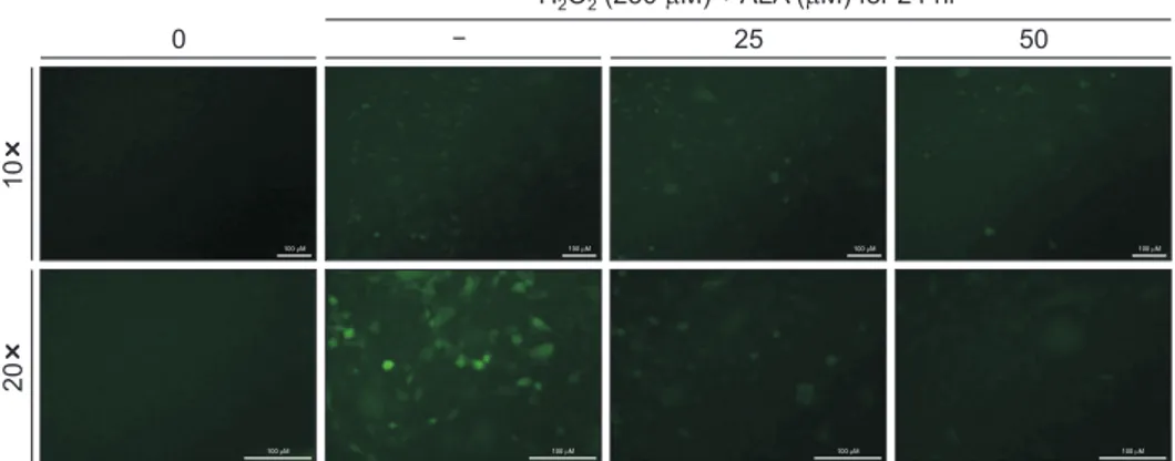 Fig. 5.   Effects of alpha-lipoic acid (ALA) on hydrogen peroxide (H 2 O 2 )-induced oxidative stress in SH-SY5Y cells