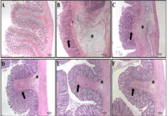 Fig.  7.  Effect  of  HPL-01  on  colorectal  histology  in  rat  with  DSS-induced colitis (×40)