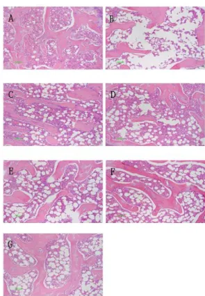 Fig.  8.  Clinical  changes  of  COX-2  (A),  NOS-2  (B),  MMP-2  (C)  and  MMP-9  (D)  mRNA  expression  in  Joint/Bone(real-time  PCR)  of  OVX  rats  after  15  weeks  treatment