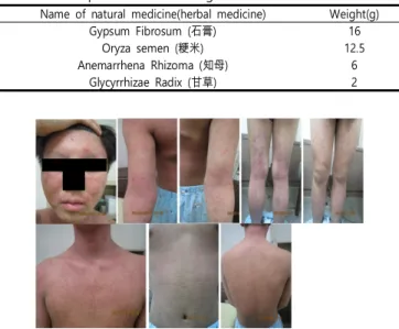 Table  1.  Prescription  of  Baekho-tang