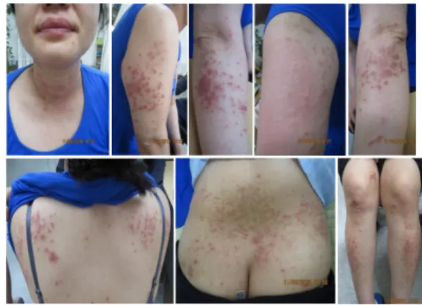 Fig.  4.  Before  Treatment  of  Baekho-tang  :  Case  2