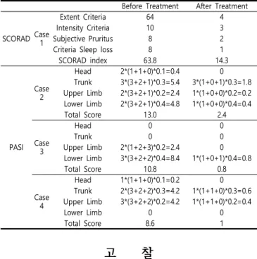 Table  2.  Clinical Progress  of  SCORAD  index &amp;  PASI score Before  Treatment After  Treatment SCORAD Case  1